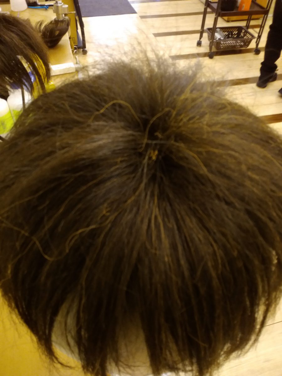 固定式のセルフケア