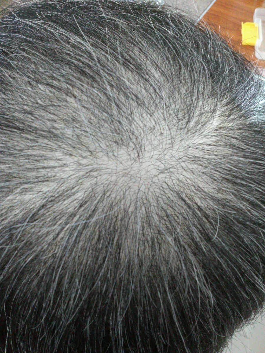 頭頂部を薄めに